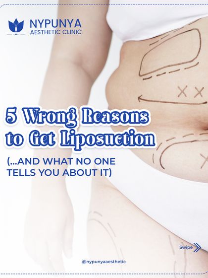 Before considering liposuction, it's crucial to understand the right and wrong reasons for the procedure. This post breaks down five common misconceptions to help you make an informed decision.