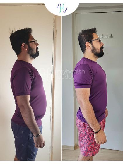 Anshul lost 10 kgs in 12 weeks, even while traveling for over a month. We made sure he stuck to his diet and step goals.
