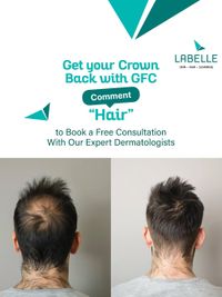 Hair Loss Treatment & Restoration