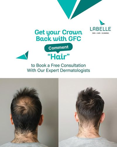 Hair Loss Treatment & Restoration