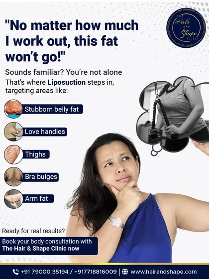 "I work out, I eat right, but this fat just won't go." This is a frustration I hear every day. Liposuction isn't a weight loss shortcut; it's a contouring tool for those stubborn pockets of fat on the belly, love handles, thighs, and arms that refuse to budge. It's the finishing touch to reveal the shape you've worked hard for.