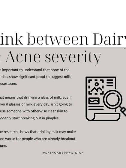 It's important to know that while studies link dairy to acne severity, they don't prove it causes acne in clear skin. It's about aggravation, not initial causation.