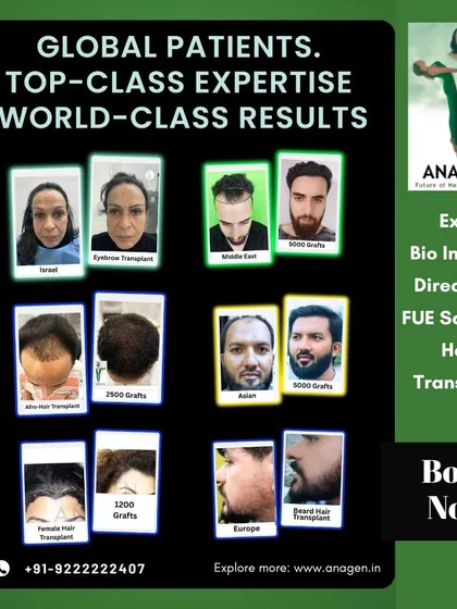 We are proud to serve a global clientele. This collage showcases the diversity of our patients from Israel to Europe and the variety of procedures we perform, including eyebrow, female, and beard hair transplants, all achieving world class results.