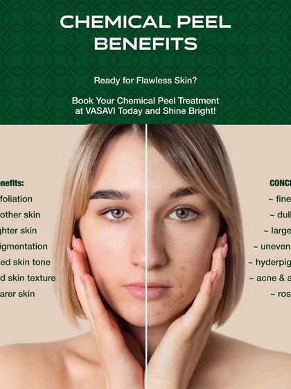 Sree Vasavi - Anti-Aging & Skin Tightening Advanced Skin Rejuvenation: Lasers & Peels photo 10