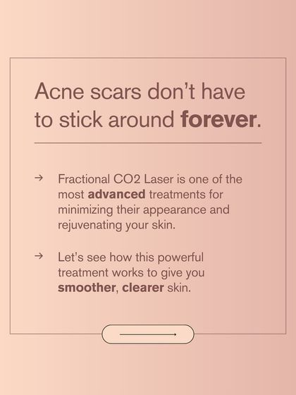Acne scars don't have to be forever. The Fractional CO2 Laser is one of the most advanced treatments for minimizing their appearance by creating smoother, clearer skin.