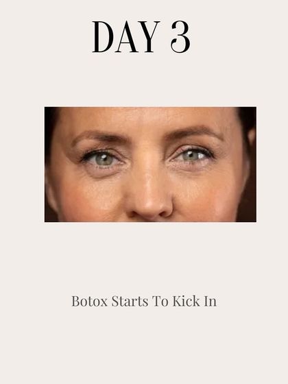 Clinic Next Face - Cosmetic Injectables Botox Treatments: Smooth Wrinkles & Refine Contours photo 13