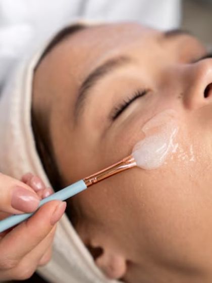 A chemical peel being applied by a professional. I use customized chemical peels to exfoliate the skin, reduce pigmentation, treat acne, and reveal smoother, brighter skin underneath.