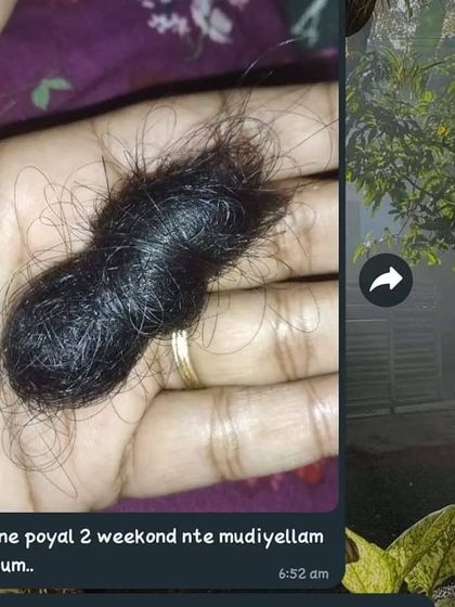 This was the "before" photo sent by my former student, showing the amount of hair she was losing in one go. It's a common problem, and I'm glad I can offer a natural solution.