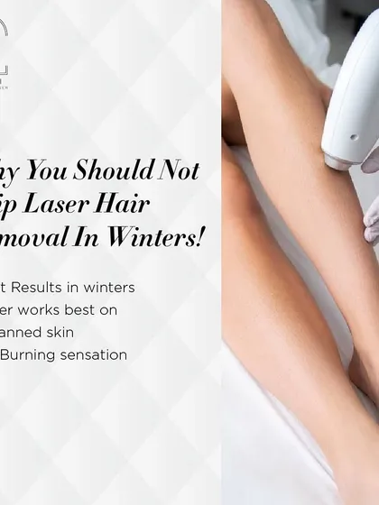 This graphic summarizes why you should not skip laser hair removal in the winter. You get the best results on untanned skin with no burning sensation.
