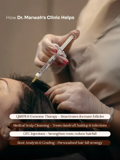 Here, a patient is undergoing a targeted GFC (Growth Factor Concentrate) injection. This procedure delivers a high concentration of growth factors directly to the scalp, strengthening hair roots and reducing hair fall with clinical precision.