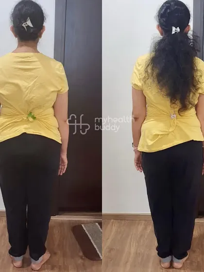 This client lost 8 kgs in 3 months. Despite a hectic work life, she balanced everything and built a new, healthy lifestyle.