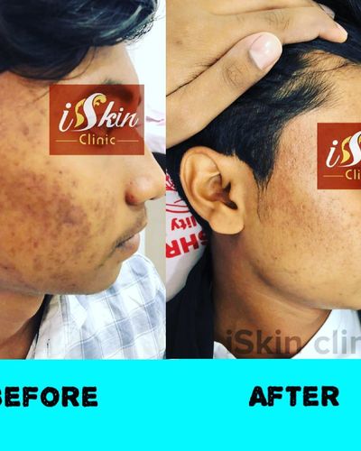 Medical Dermatology