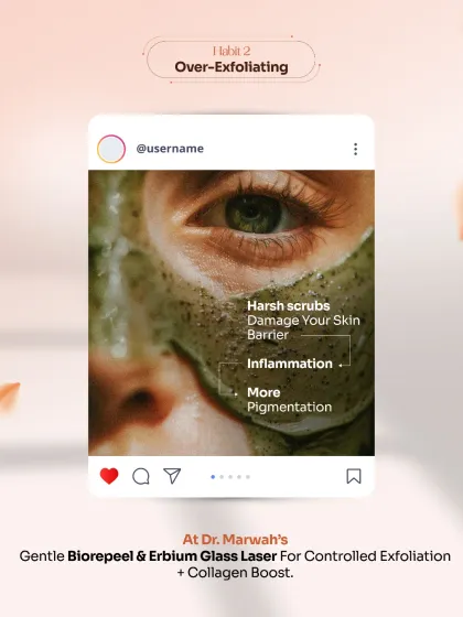 Habit 2: Over-Exfoliating. Using harsh physical scrubs can damage your skin's protective barrier, leading to inflammation and more pigmentation. We use gentle BioRePeel and Erbium Glass Laser for controlled exfoliation that also boosts collagen.