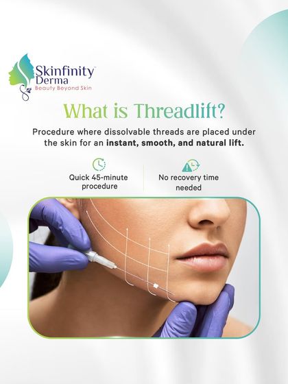 What is a Threadlift? It's a quick 45-minute procedure where we place dissolvable threads under the skin for an instant, smooth, and natural lift with no recovery time.