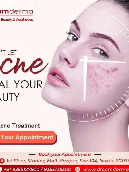 Time to stop letting acne control your life. Our targeted acne treatments are designed to give you back your clear, beautiful skin. Book an appointment to start your journey to a blemish-free complexion.