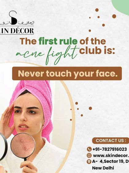 The first rule of the acne fight club is to never touch your face. Picking or squeezing pimples introduces bacteria and creates more inflammation, which can lead to infection and permanent scarring. A hands-off approach is always best.
