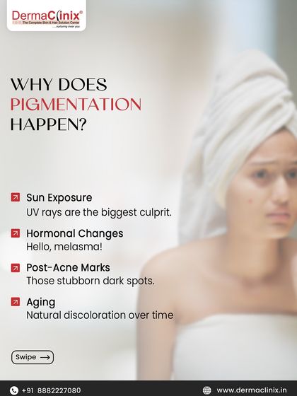An infographic explaining the common causes of pigmentation. Sun exposure, hormonal changes (melasma), post-acne marks, and aging are the primary reasons for skin discoloration.