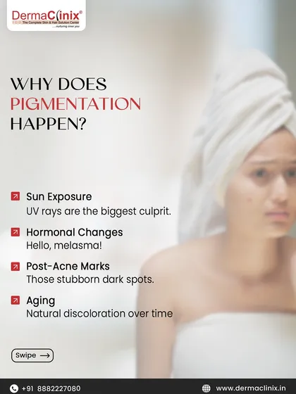 An infographic explaining the common causes of pigmentation. Sun exposure, hormonal changes (melasma), post-acne marks, and aging are the primary reasons for skin discoloration.
