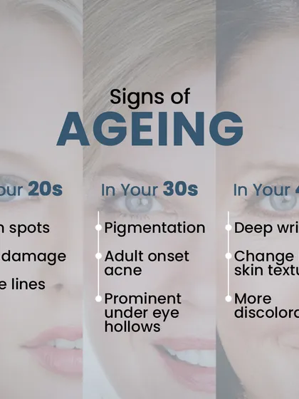 This chart shows the different signs of aging that typically appear in your 20s, 30s, and 40s. Understanding this progression helps in creating a preventative skincare plan.