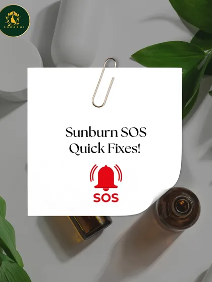 If you do get a sunburn, we have some quick fixes. This series of posts will guide you on how to soothe and heal your skin naturally.