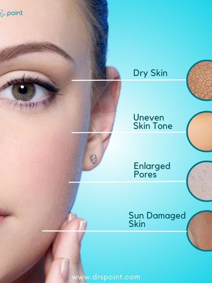 A visual guide to the skin concerns that can be effectively addressed with a HydraFacial, such as dryness, enlarged pores, and uneven skin tone.