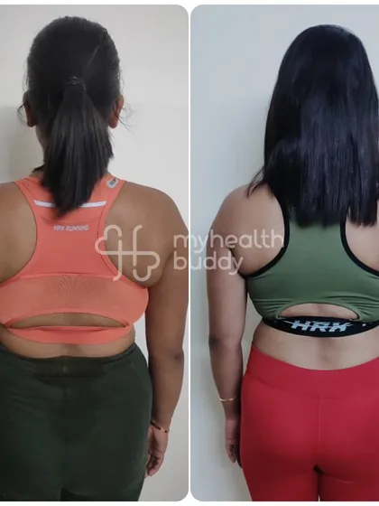 Sangita lost 5 kgs in 3 months. Her back transformation shows improved muscle tone and a reduction in body fat.