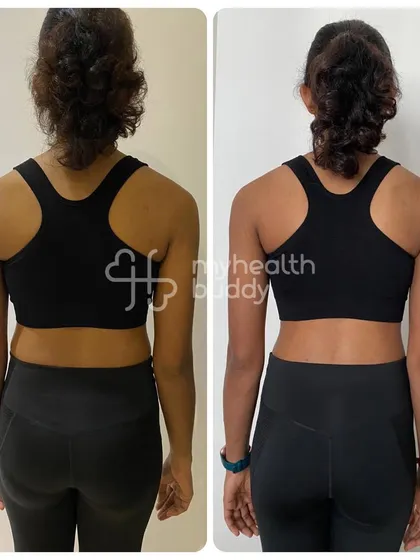 Logeswary's back progress. Her transformation proves that you don't have to fear eating meat or home-cooked food to achieve your fitness goals.