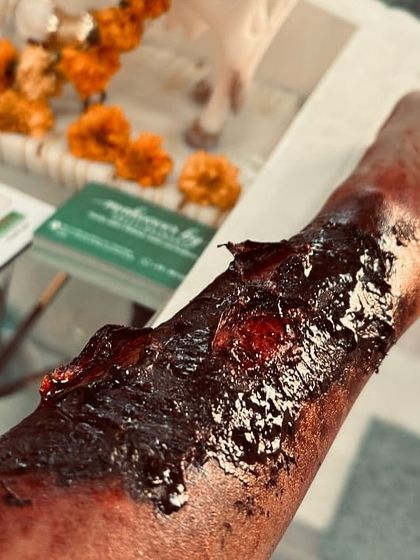 Another angle of the severe burn prosthetic on an arm. The combination of deep reds and blackened areas creates a convincing illusion of a third-degree burn, suitable for any production needing authentic injury effects.