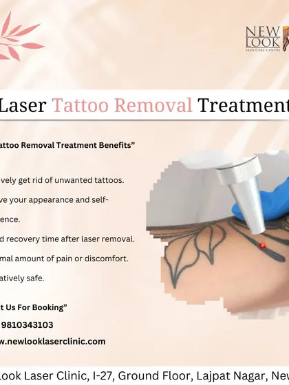 We believe in making the process as comfortable as possible. As this graphic explains, our laser tattoo removal treatment is a safe procedure with minimal discomfort, designed to improve your appearance and boost your self-confidence.