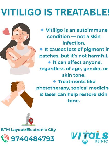 Vitals Klinic - Medical Dermatology Vitiligo & Pigment Restoration photo 8
