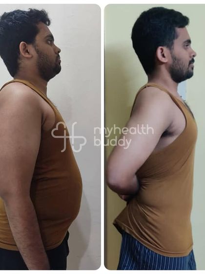 A side view of Gowtham's 20kg weight loss. The change in his posture and reduction in belly fat is remarkable.
