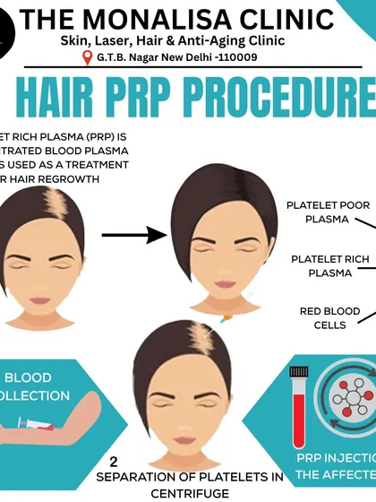 This visual guide breaks down the three simple steps of our Hair PRP procedure: blood collection, separation of plasma in a centrifuge, and injection into the scalp to stimulate hair regrowth.