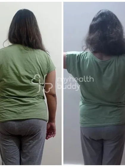 The back view of the same 48-year-old client's transformation. She learned that you don't have to starve yourself to lose weight.