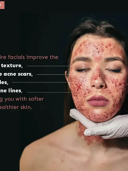 The key benefits of a vampire facial include improved skin texture, diminished acne scars, and a reduction in fine lines and wrinkles. The result is naturally softer, healthier, and more youthful-looking skin.
