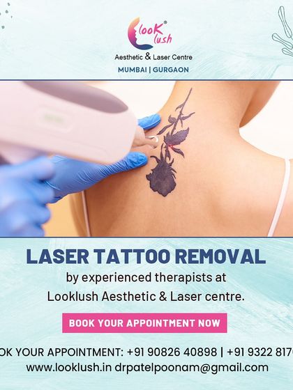 This graphic shows a laser tattoo removal treatment in progress. If you have a permanent tattoo you no longer want, my painless laser treatment can help you get rid of it.
