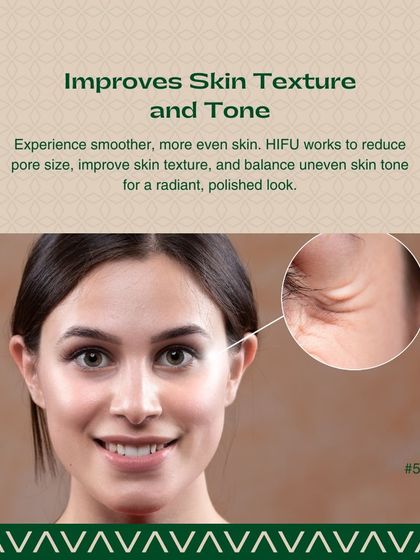 Sree Vasavi - Anti-Aging & Skin Tightening Non-Surgical Face & Neck Lifting photo 6