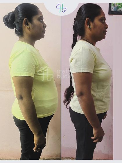 Side view of Rekha's 9kg transformation.