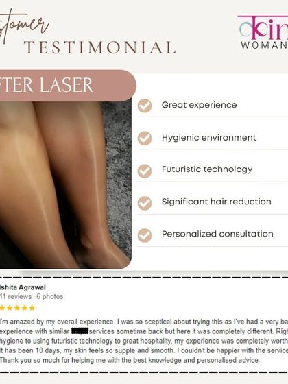 This client was skeptical after a previous bad experience elsewhere but was amazed by her journey with us, from the hygiene and technology to the personalized advice and smooth skin.