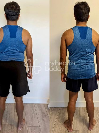 This vegetarian client lost 5 kgs and significant body fat in 3 months, even with a lot of work travel. He stuck to his meal plan and used hotel gyms, showing that determination overcomes any obstacle.