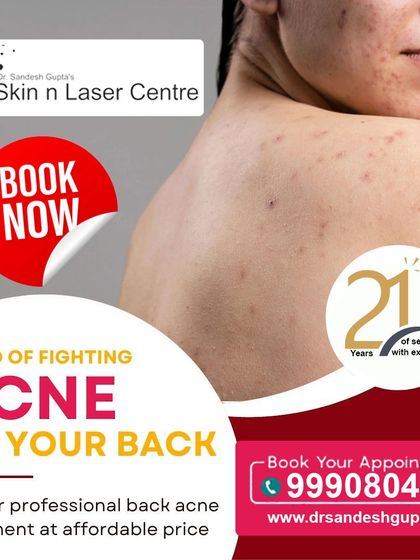 Tired of fighting acne on your back? I offer professional back acne treatments at an affordable price. With 21 years of service, my clinic is equipped to handle persistent body acne and help you achieve clear skin.