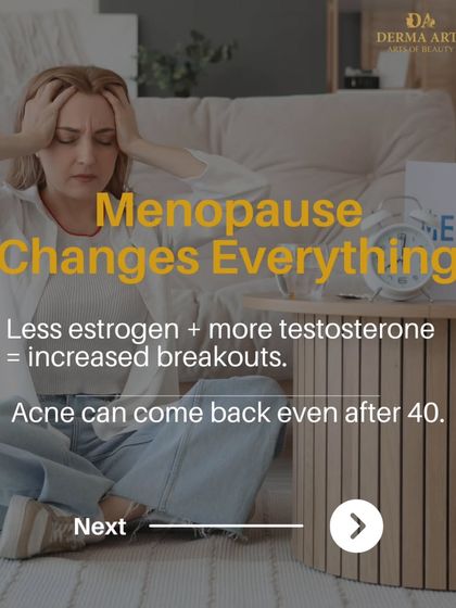 Menopause changes everything. This graphic shows how a drop in estrogen and a rise in testosterone can cause acne to return, even after 40.