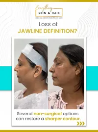 Anti-Aging & Facial Contouring