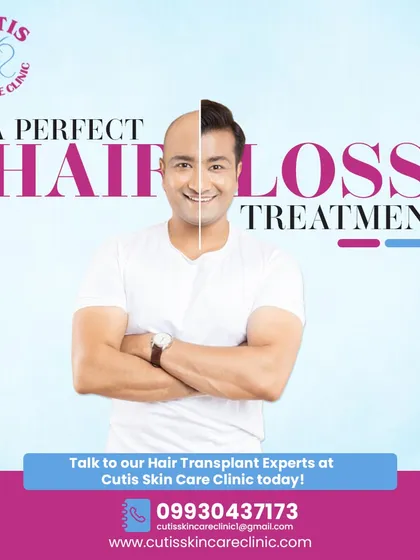A split-image graphic demonstrating a successful hair loss treatment. The left side shows a man with noticeable hair thinning, while the right side shows him with a full, healthy head of hair, representing the perfect solution for hair restoration.