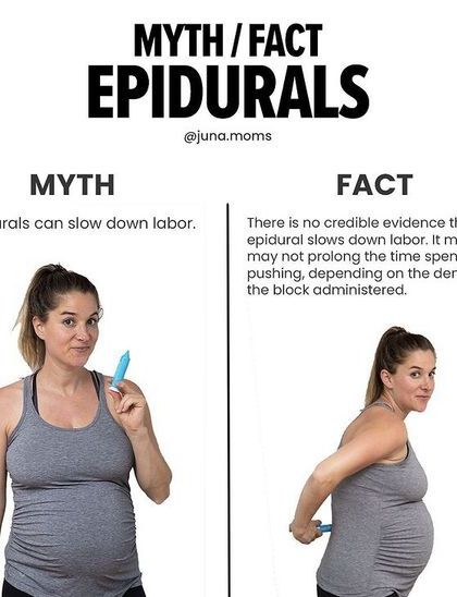 This myth-busting graphic addresses the common fear that epidurals slow down labor. The fact is, there is no credible evidence for this, and the choice for pain relief is a personal one.