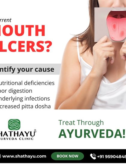 Recurrent mouth ulcers are often a signal of deeper issues like poor digestion, nutritional deficiencies, or an increased pitta dosha. We identify and treat the underlying cause to prevent them from coming back.