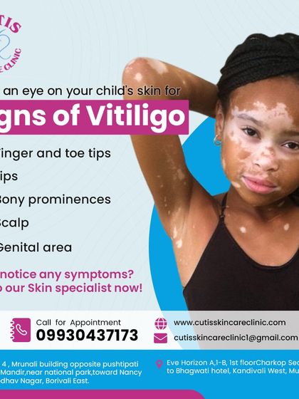 It is important to keep an eye on your child's skin for early signs of vitiligo. This graphic highlights common areas where depigmented patches may appear, such as fingertips, lips, and the scalp. Early detection is key, so talk to our skin specialists if you notice any symptoms.