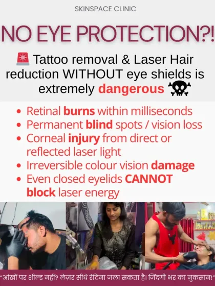 Performing laser treatments without proper eye protection is extremely dangerous and can cause irreversible eye damage. At our clinic, we ensure both the patient and the operator use certified protective shields during every session.