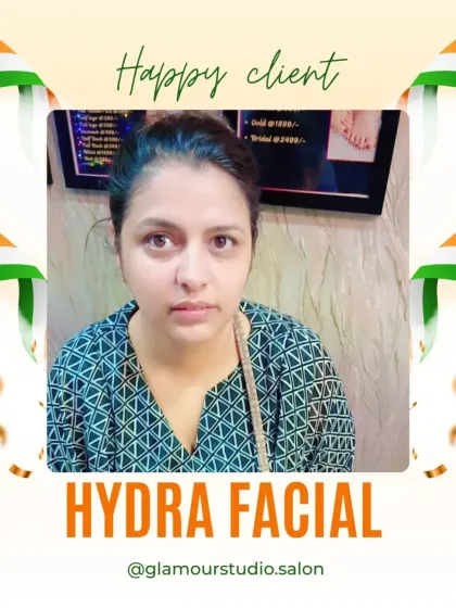 This client's skin looks refreshed and rejuvenated after her Hydra Facial. We focus on delivering visible results.