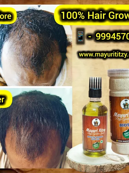 This is why I do what I do. This before and after image shows the real possibility of hair regrowth with consistent use of my Biotin Powder and Magical Herbal Hair Oil. It’s not a quick fix, but a natural journey to healthier hair.