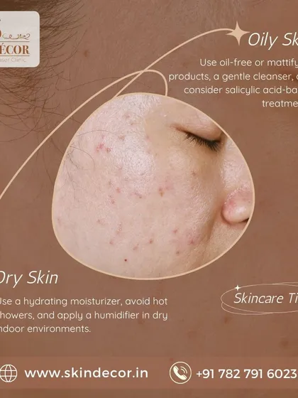 Your skin type determines your skincare needs. For oily skin, focus on oil-free products and salicylic acid-based treatments. For dry skin, prioritize a hydrating moisturizer, avoid hot showers, and consider using a humidifier to keep your skin barrier healthy.
